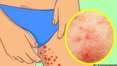 Yaz aylarında hepimizin yaşadığı sorunları nasıl gideririz?