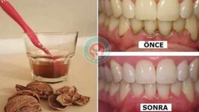 1 Malzeme ile ışıl ışıl dişlere kavuşacaksınız