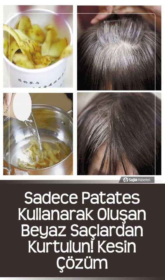 Sadece patates kullanarak oluşan beyaz saçlardan kurtulun! Kesin Çözüm