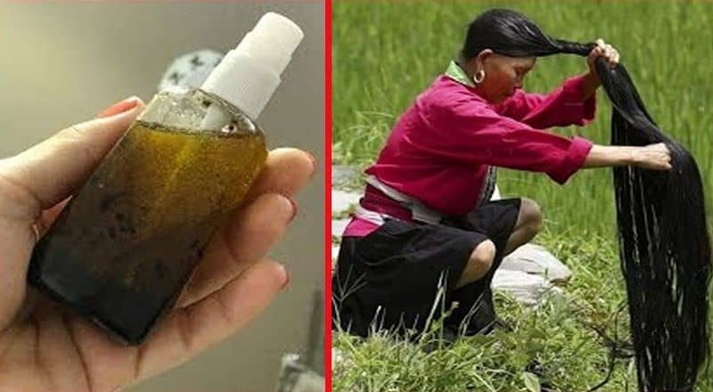 729fbd319567c1fc8006b503026b3261 Bunu Saçına Sürdükten 2 Hafta Sonra Gözlerine İnanamadı!