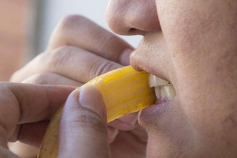 Muz Kabuğunun Bu Faydalarına İnanamayacaksınız!