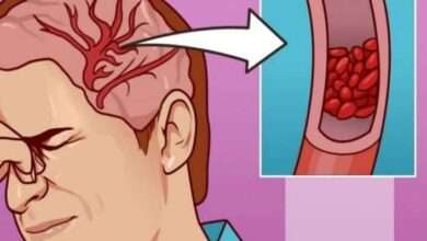 Acilen magnezyuma ihtiyacınızın olduğunun 13 işareti