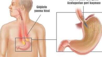 Asit Reflüsü İçin 6 Tedavi