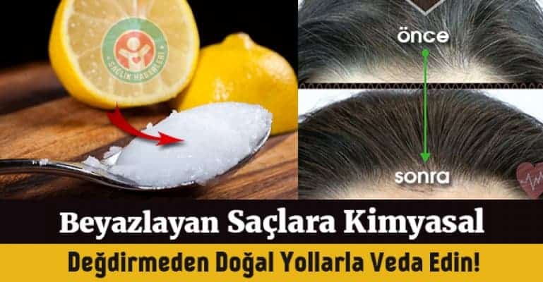 Beyazlayan saç tekrar siyahlaşır mı, saçtaki beyazlar nasıl yok olur?