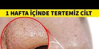 Burnunuzda bulunan siyah noktalardan kurtaracak 5 yöntem