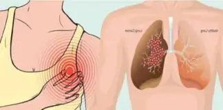 Çağımızın ölümcül hastalığı akciğer kanserinin 12 belirtisi
