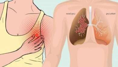 Çağımızın ölümcül hastalığı akciğer kanserinin 12 belirtisi
