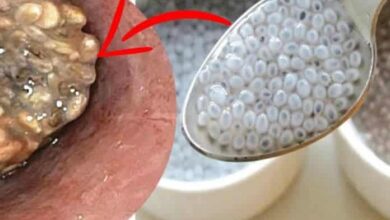 Chia Tohumunun Faydaları Ve Zararları Nelerdir?