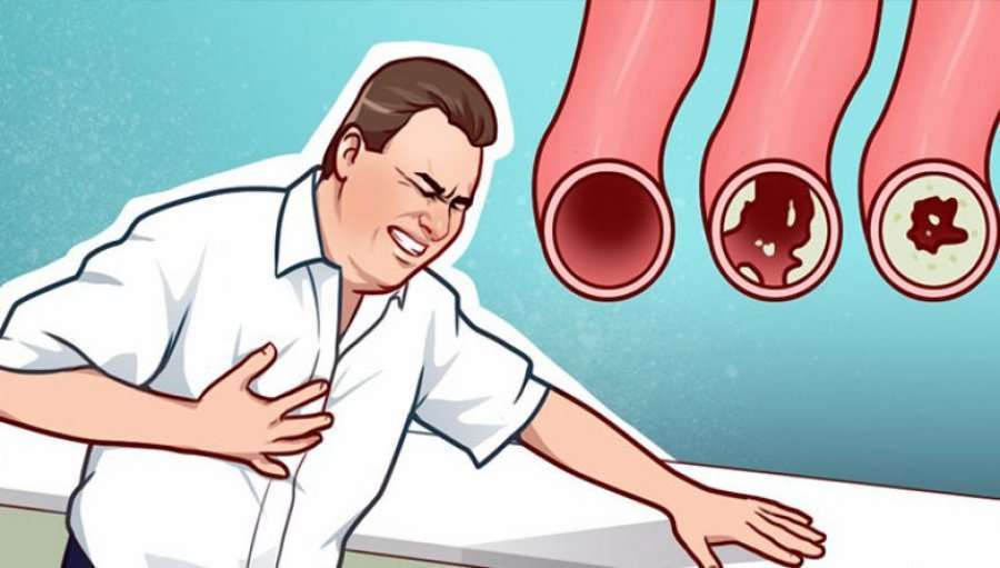 damarlari temizleyen 10 mucizevi besin sha Damarları temizleyen 10 mucizevi besin!