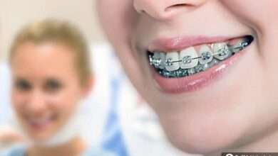 Diş teli ile dişler nasıl fırçalanır?