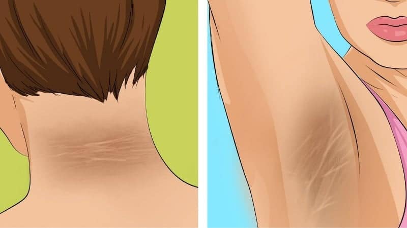 dmnfEX5P3Vg Bu 7 belirtinin 4’ü varsa, kan şekeriniz yüksektir önlem alın!