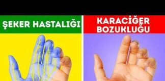 Ellerinizin sizi uyardığı 12 sağlık sorunu göz ardı etmeyin
