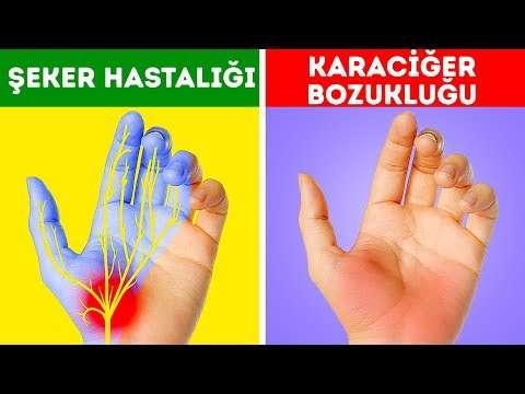 Ellerinizin sizi uyardığı 12 sağlık sorunu göz ardı etmeyin