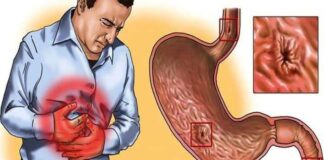 Gastrit veya reflünüz varsa bu 5 gıdayı asla tüketmeyin!