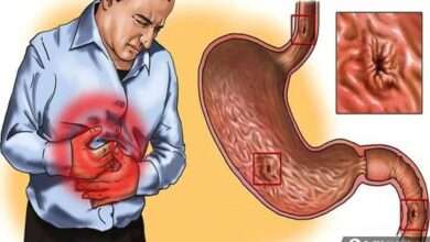 Gastrit veya reflünüz varsa bu 5 gıdayı asla tüketmeyin!