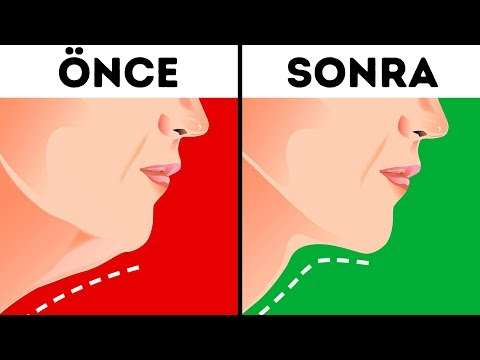 Gıdınızdan kurtulmak için 6 etkili yol