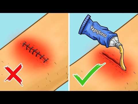 Hayatta kalmanızı sağlayacak 12 pratik bilgi