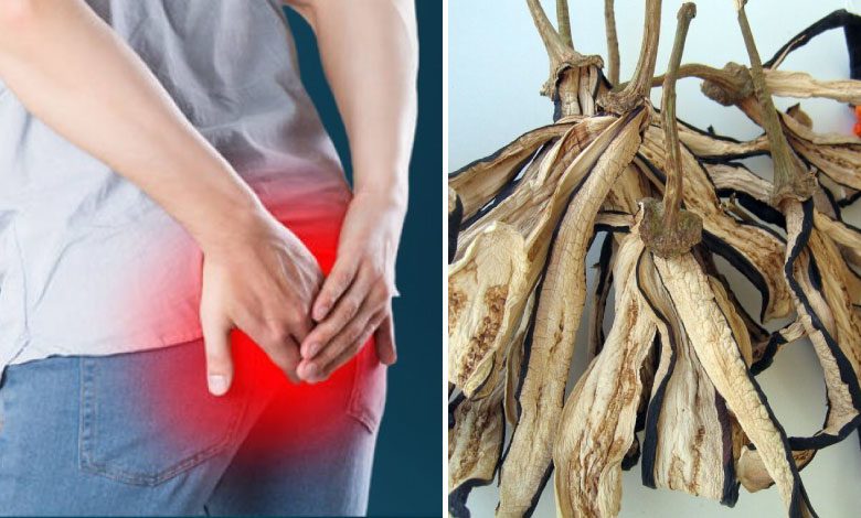 Hemoroit hastalığının çaresi patlıcan sapı