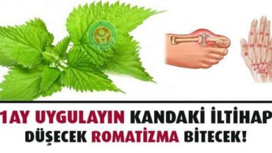 İltihaplı Eklem Romatizması