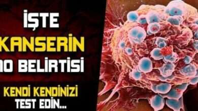 İşte kanserin 10 belirtisi