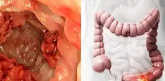 İşte Kerevizin Sağlık İçin Mucizevi Faydaları