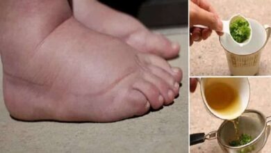 Kadınların En Büyük Derdi Ödem İçin Çay Tarifi