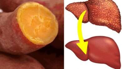 Karaciğer yağlanmasının nedenleri, belirtileri ve tedavisi