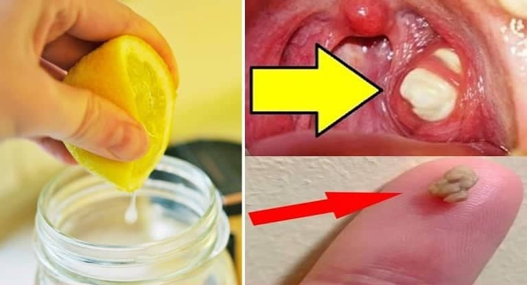 Kötü Nefesi Ortadan Kaldıran Mucize