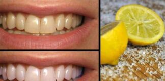 Limon ile ağız sorunlarını nasıl tedavi edersiniz?