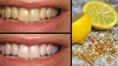 Limon ile ağız sorunlarını nasıl tedavi edersiniz?