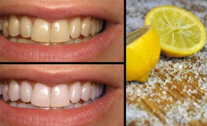 Limon ile ağız sorunlarını nasıl tedavi edersiniz?
