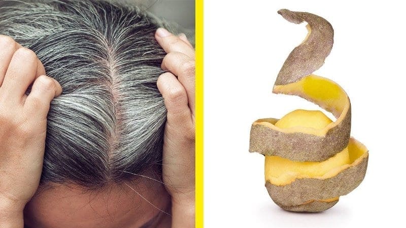 maxresdefault 2 4 Sadece patates kullanarak oluşan beyaz saçlardan kurtulun! Kesin Çözüm