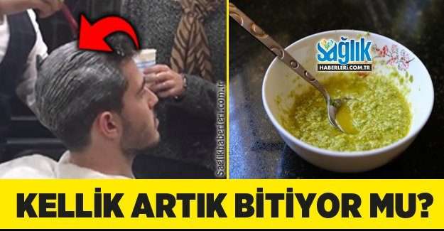 Saç dökülmesine ve yeniden saç çıkmasına bitkisel çözüm! 1 Saç dökülmesine ve yeniden saç çıkmasına bitkisel çözüm!