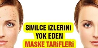 Sivilce ve izleri yok eden maske tarifi