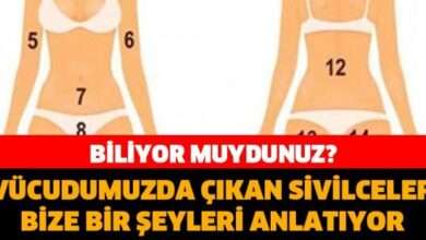 Vücudumuzda çıkan sivilceler bize neyi anlatıyor?