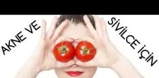 Sivilce, akne ve cilt lekelerinden kurtulmak için yüzünüze domates sürün!