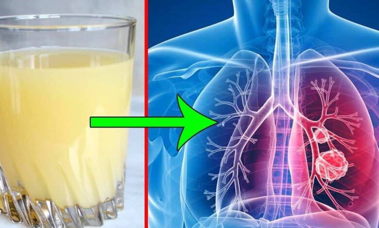 sokovi detox Akciğeri Temizleyen Yiyecekler