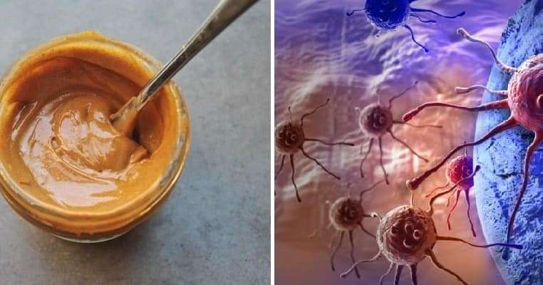 turmeric honey kills cancer Bal Ve Karbonat İle Ölümcül Hastalık İçin Şaşırtıcı Bir Tedavi!