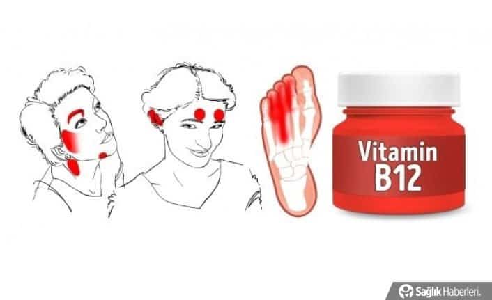 Vitamin eksikliğinizi yüzünüzden anlayacağınız 6 işaret! 1 Vitamin eksikliğinizi yüzünüzden anlayacağınız 6 işaret!