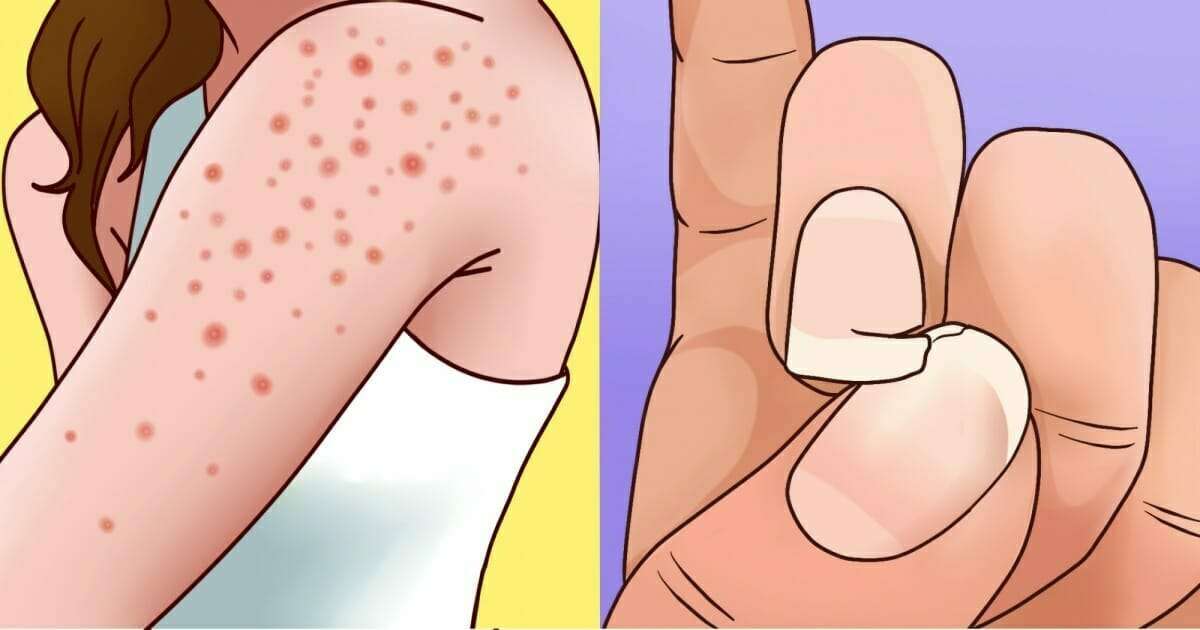 vucudunuz sizi uyariyor gluten duyarliliginizin oldugunun 9 belirtisi sha 1 Vücudunuz Sizi Uyarıyor! Gluten Duyarlılığınızın Olduğunun 9 Belirtisi!