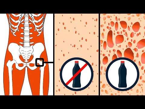 Vücudunuza zarar verebilecek 9 yiyecek!