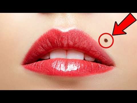 Vücudunuzda bulunan benlerdeki saklı gerçekler