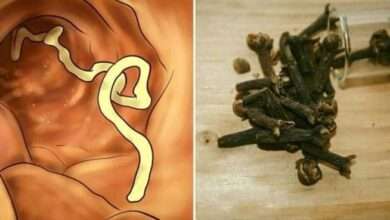 Vücudunuzda parazit olduğunu gösteren 10 belirti ve onları yok edecek 7 gıda