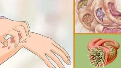 Vücudunuzdaki parazitleri doğal yöntemlerle yok edin!