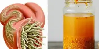 Vücuttaki Enfeksiyonu Ve Parazitleri Öldüren En Güçlü Doğal Antibiyotik