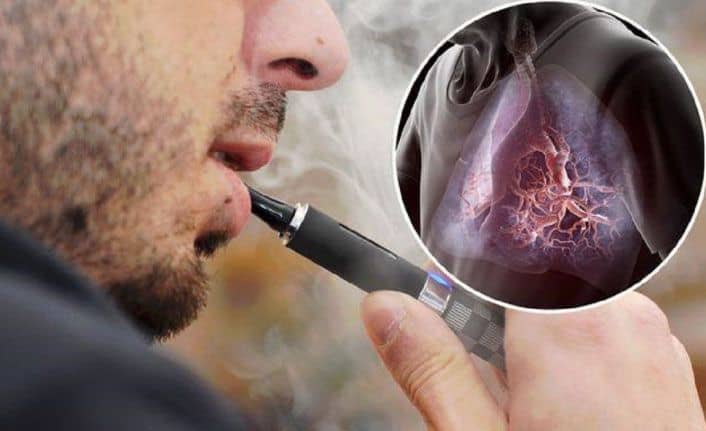 E-Sigaraların (Elektronik) Kansere ve Kalp Hastalıklarına Etkisi