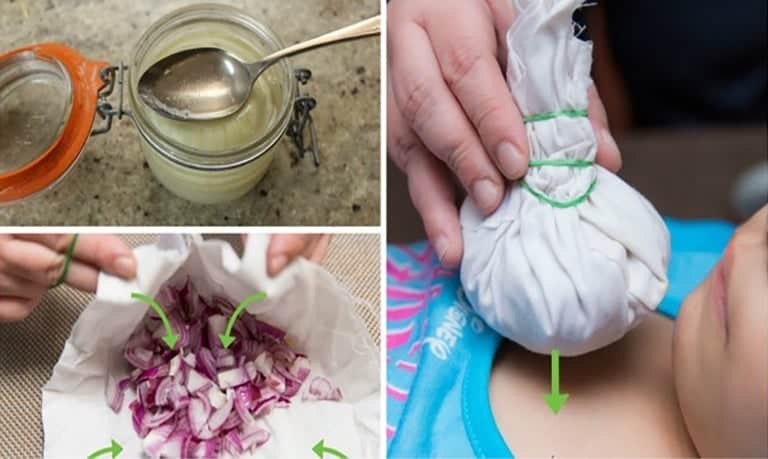 Hiç Kimse Soğanın Bu Mucizevi Etkilerine İnanamıyor!