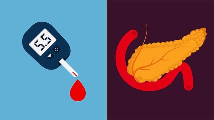 Kanser ve Diyabet Nedir Kanser ve Diyabet Arasında Bir Bağ Var Mıdır