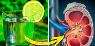 Limon Suyu Faydaları Nelerdir Limon Suyu ile Tedavi Edebileceğiniz 8 Sağlık Problemi