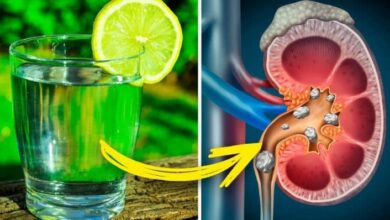 Limon Suyu Faydaları Nelerdir Limon Suyu ile Tedavi Edebileceğiniz 8 Sağlık Problemi